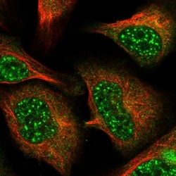 BORCS7 Antibody, Novus Biologicals 0.1mL; Unlabeled:Antibodies, Polyclonal